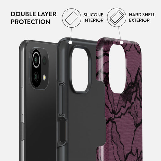 That Girl - Xiaomi Mi 11 Lite 4G / 5G Case 2