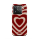 Sweet Affair -Xiaomi 15 Pro Case 1